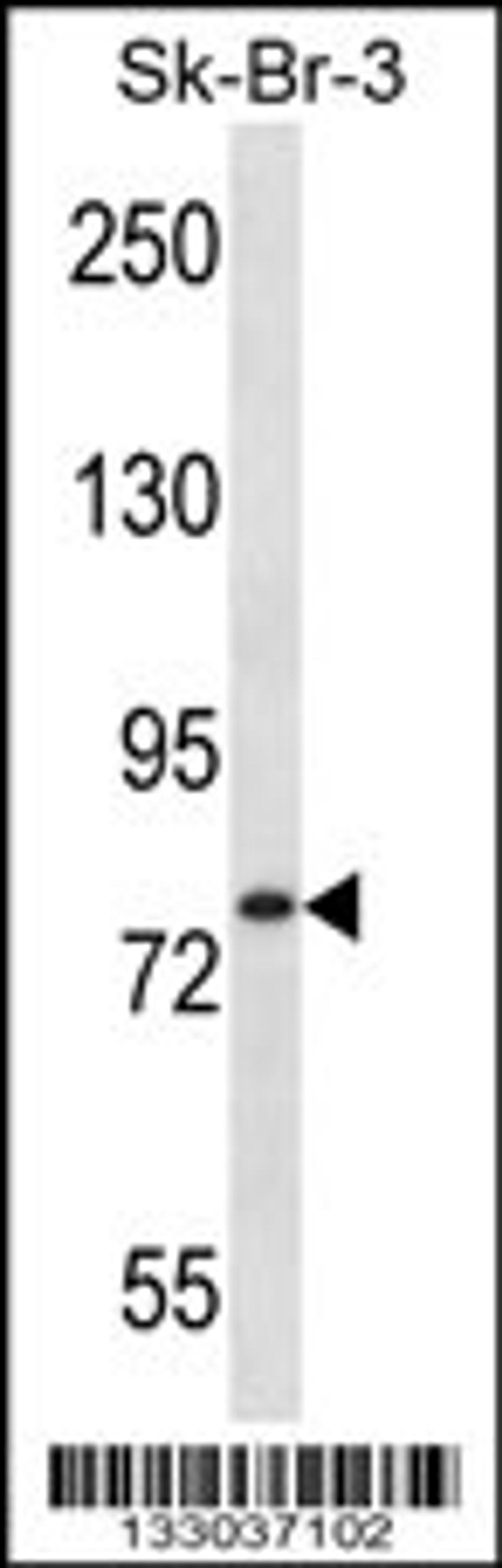 Western blot analysis in SK-BR-3 cell line lysates (35ug/lane).