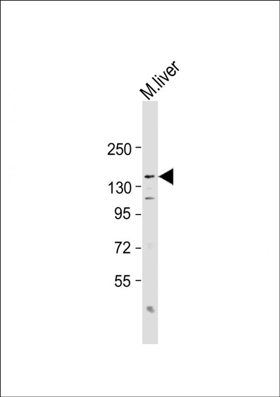 Western Blot at 1:2000 dilution + mouse liver lysate Lysates/proteins at 20 ug per lane.