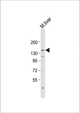 Western Blot at 1:2000 dilution + mouse liver lysate Lysates/proteins at 20 ug per lane.