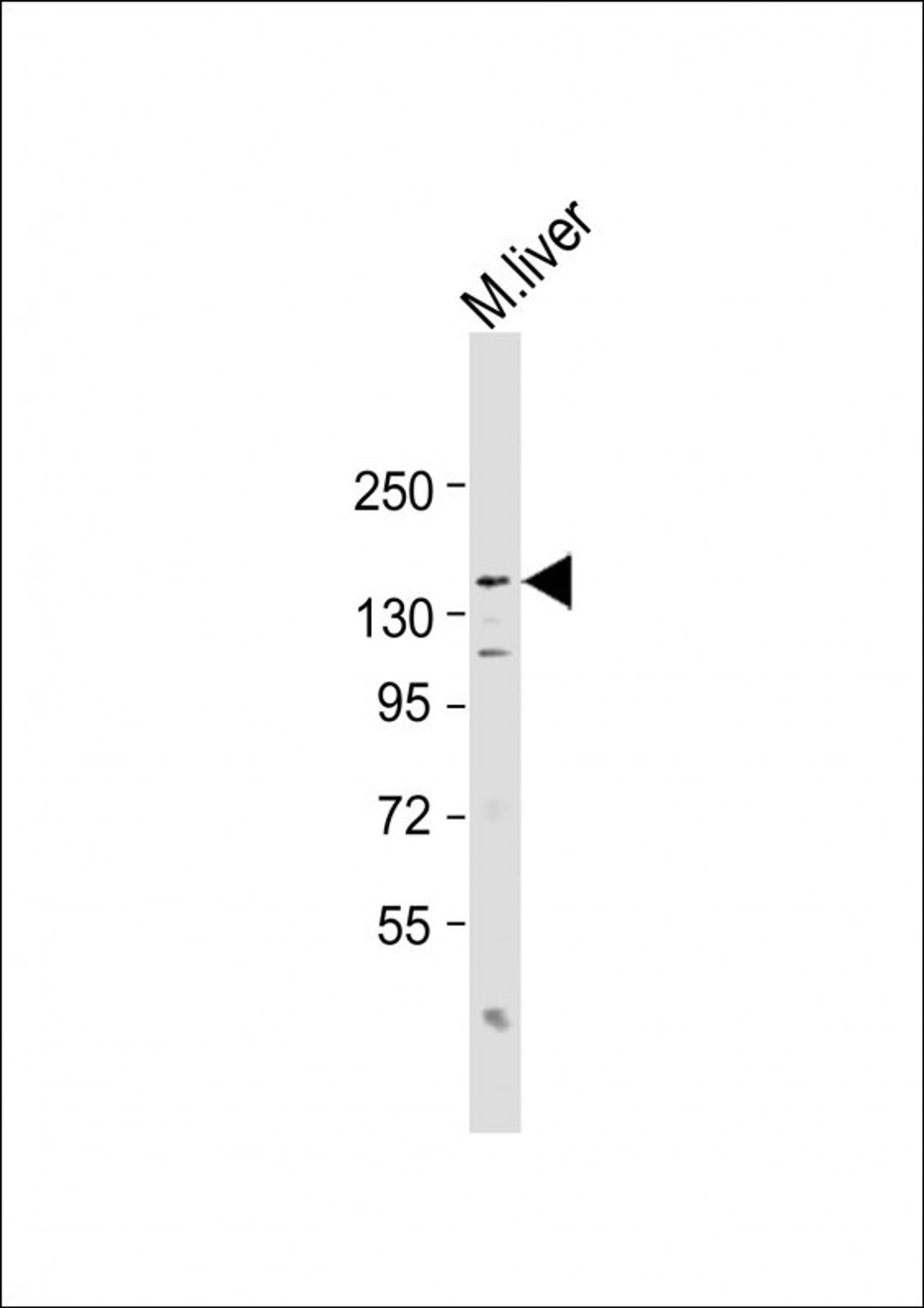 Western Blot at 1:2000 dilution + mouse liver lysate Lysates/proteins at 20 ug per lane.