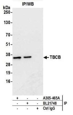 Detection of human TBCB by western blot of immunoprecipitates.