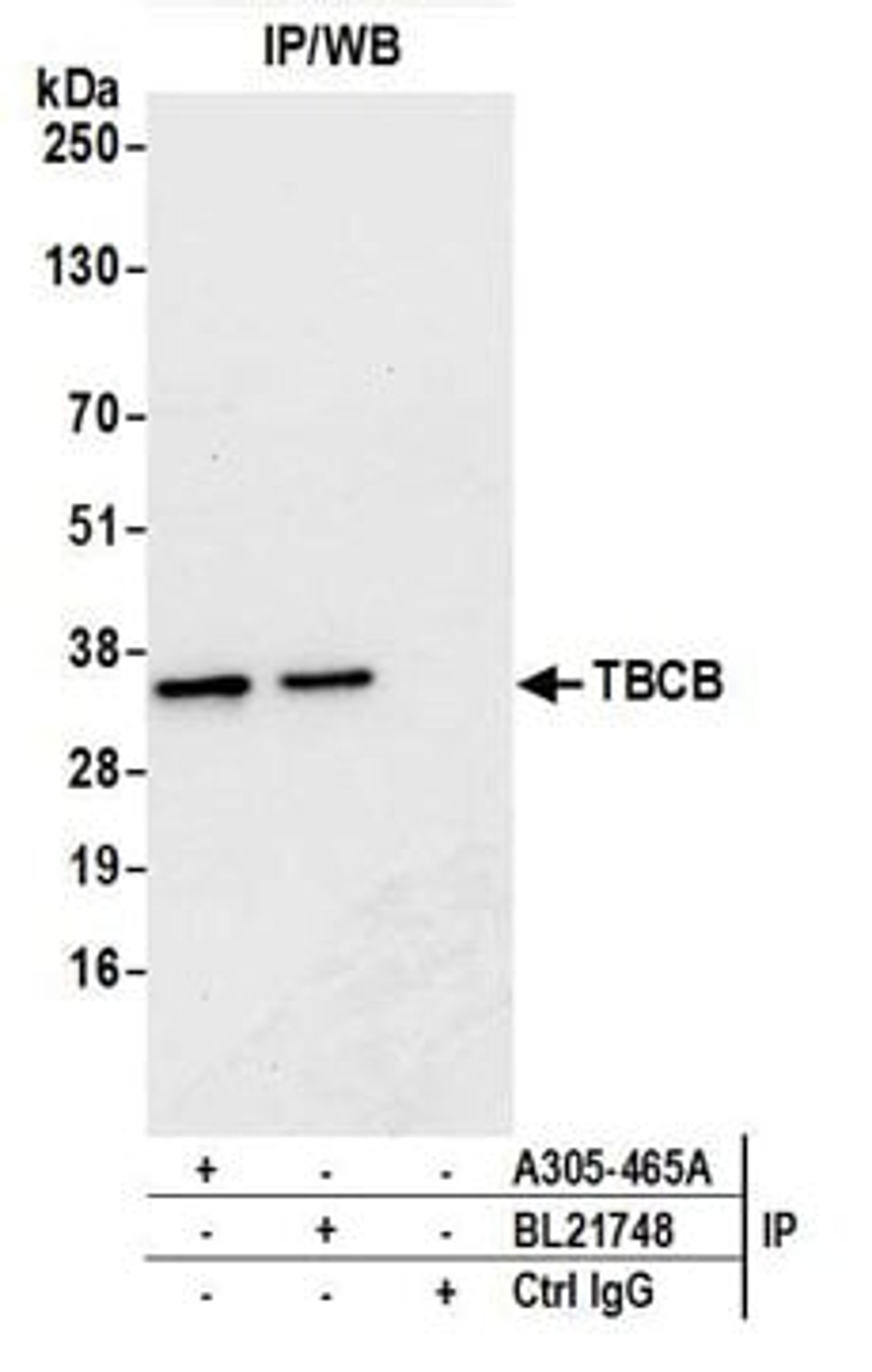 Detection of human TBCB by western blot of immunoprecipitates.