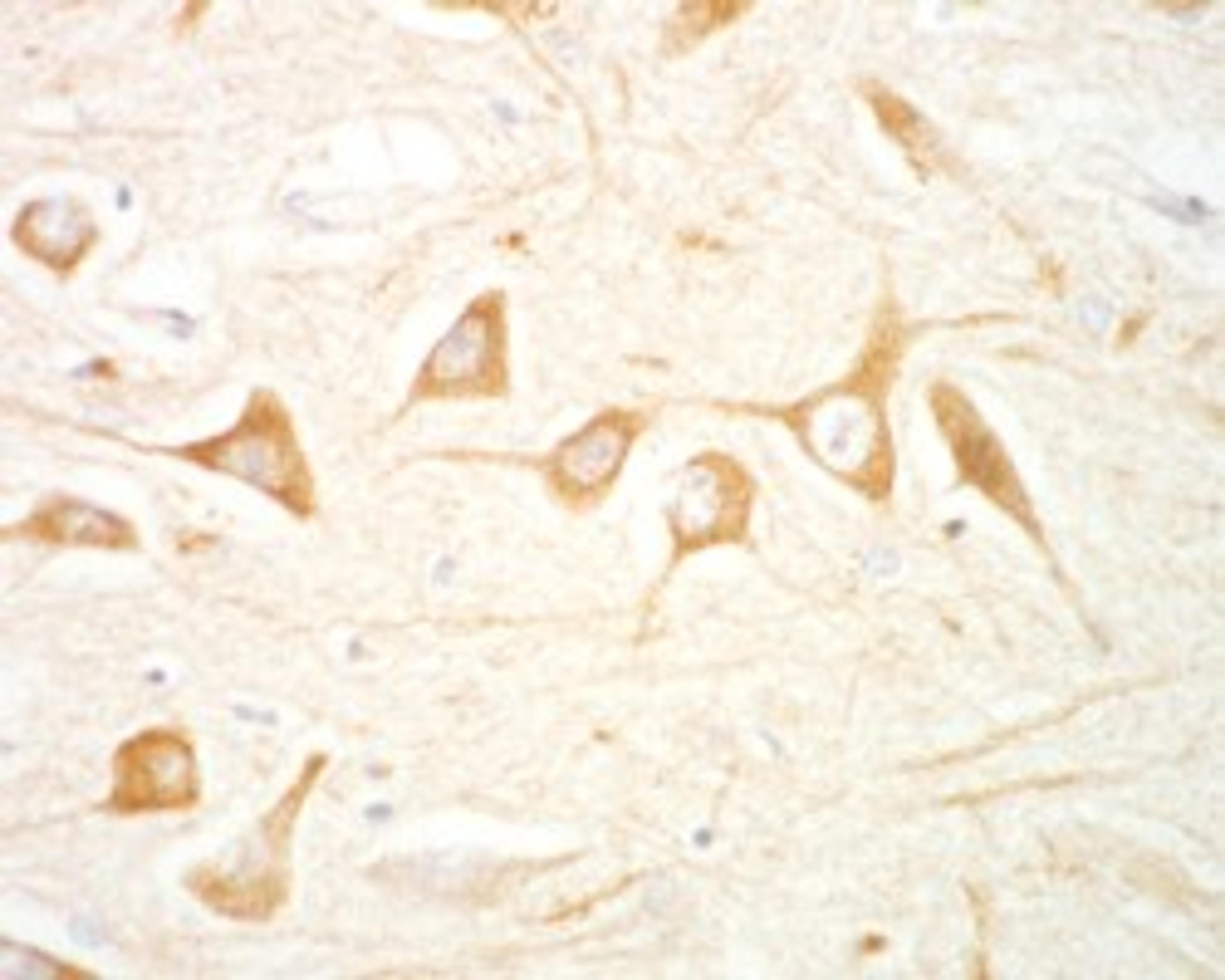 45-848 (1.5ug/ml) staining of paraffin embedded Human Hippocampus CA4. Microwaved antigen retrieval with citrate buffer pH 6, HRP-staining.