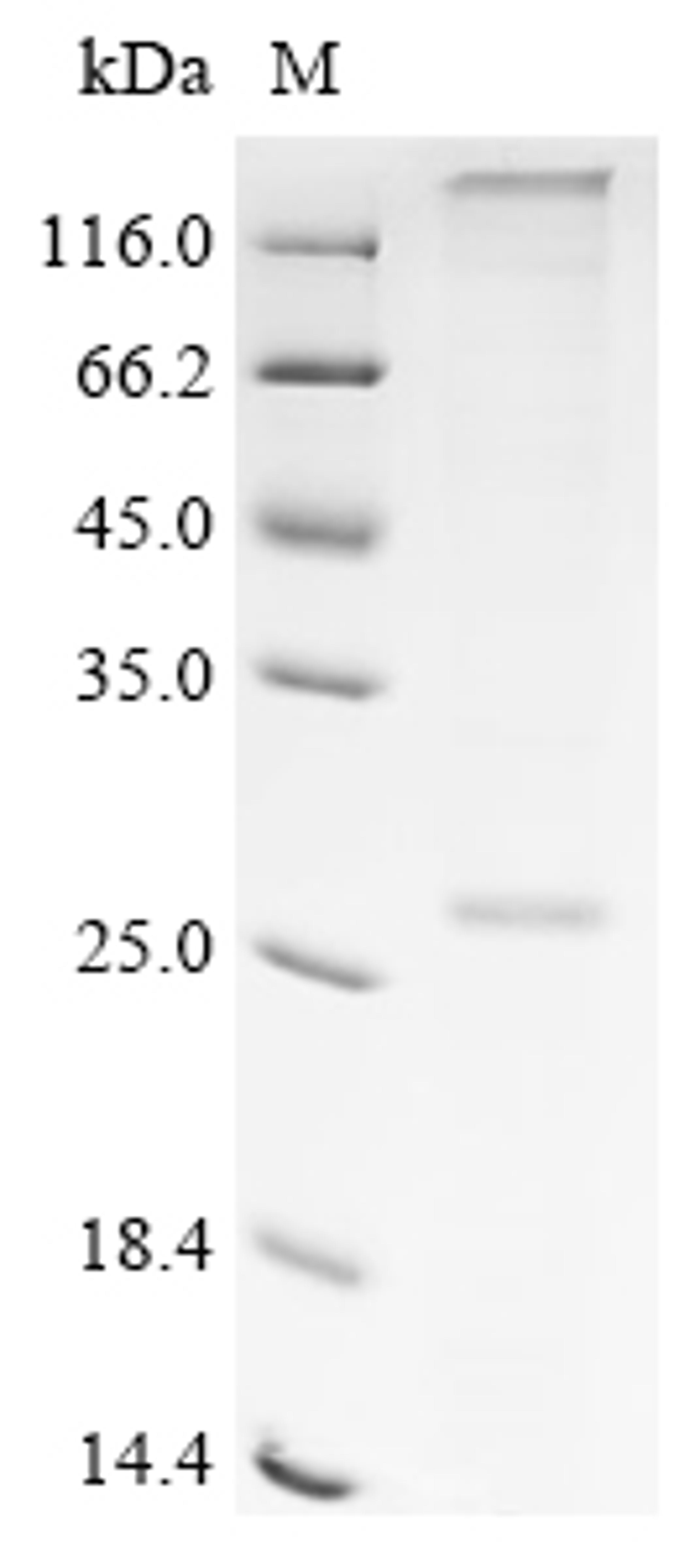 (Tris-Glycine gel) Discontinuous SDS-PAGE (reduced) with 5% enrichment gel and 15% separation gel.
