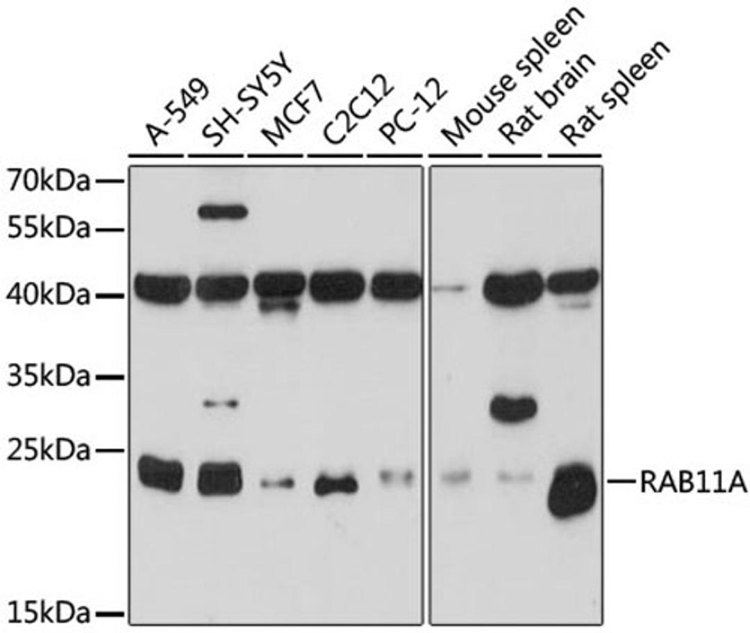 Western blot - RAB11A antibody (A17031)