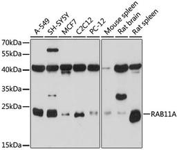 Western blot - RAB11A antibody (A17031)