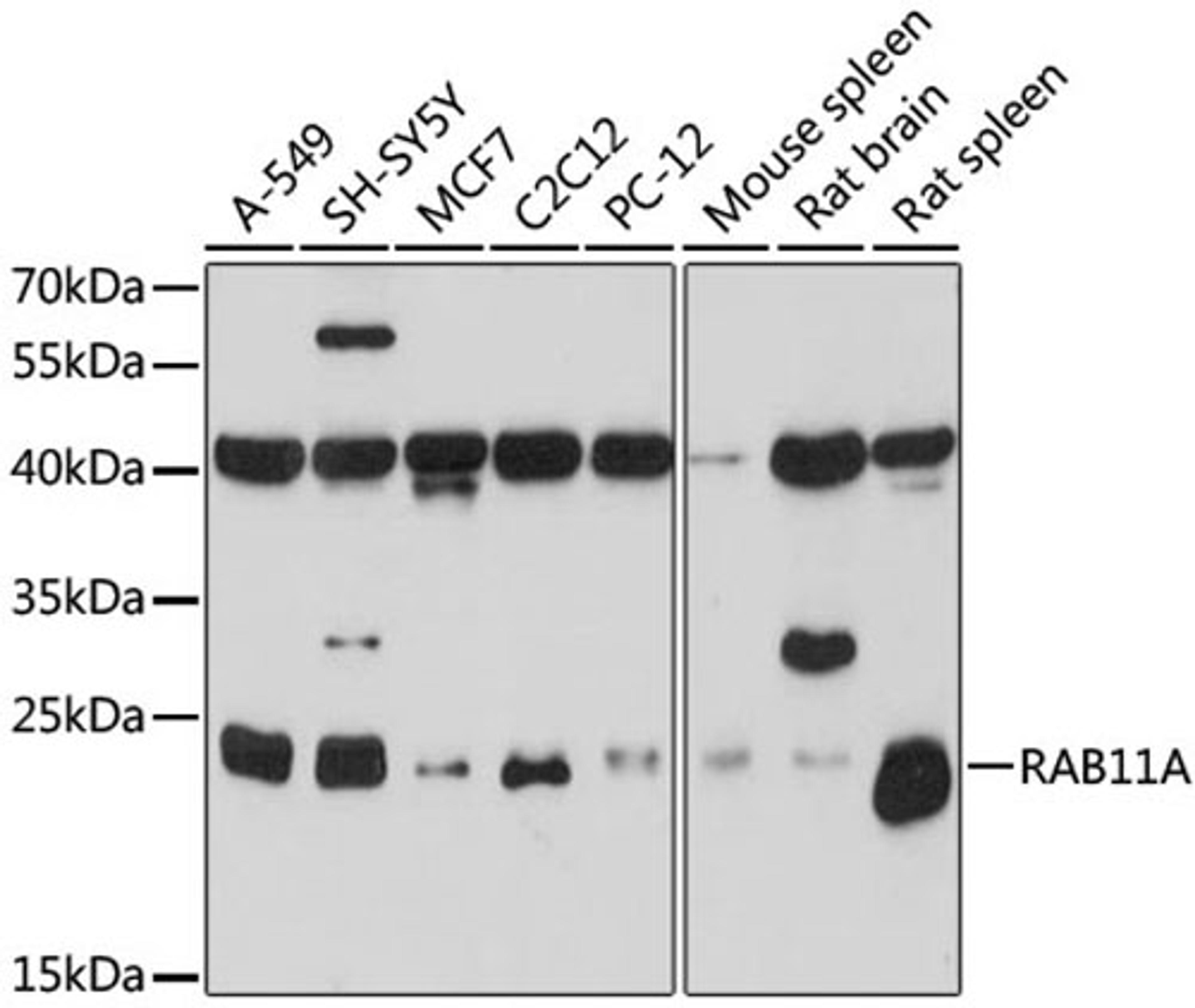 Western blot - RAB11A antibody (A17031)