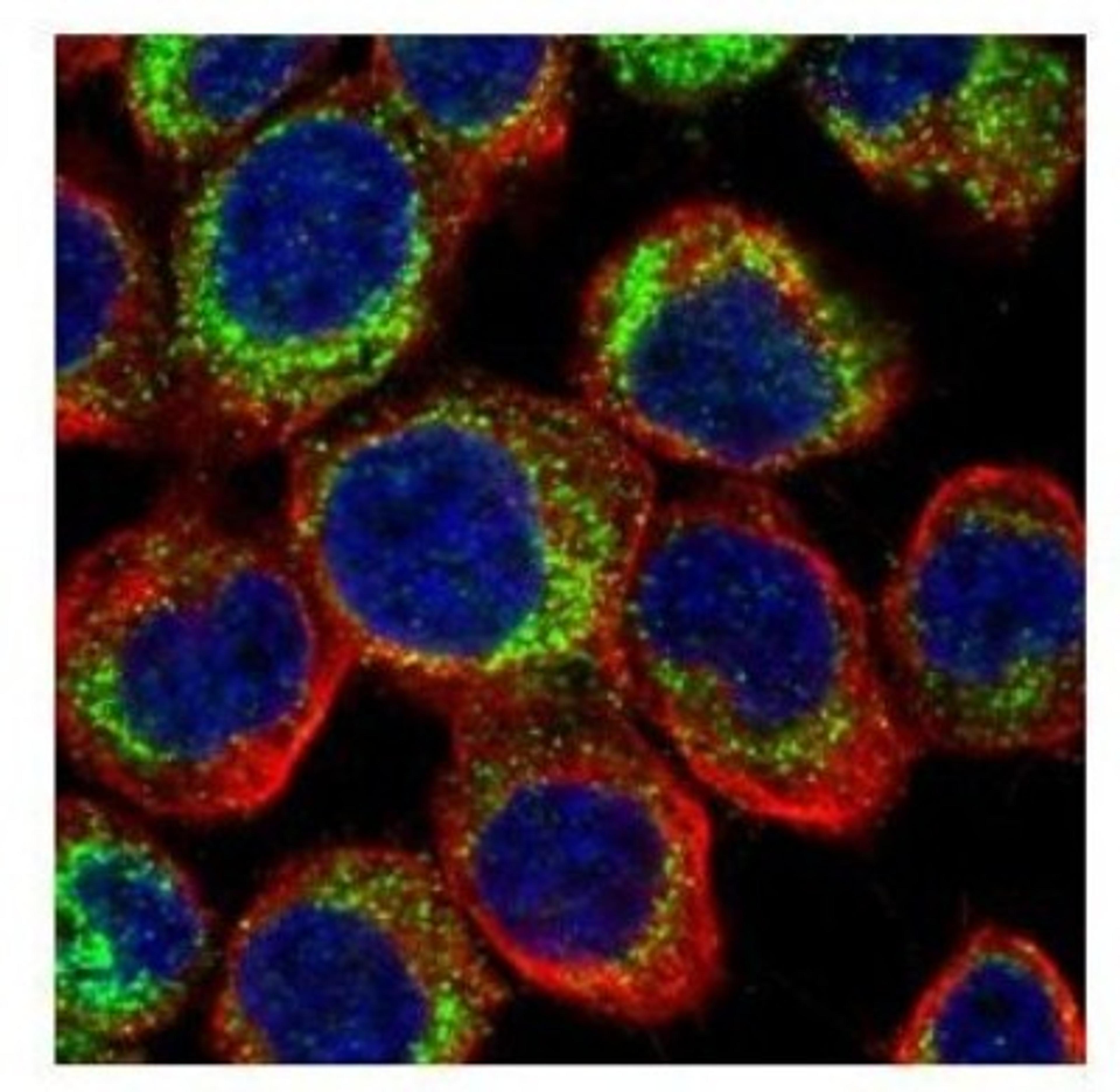 Immunocytochemistry/Immunofluorescence: Phosphodiesterase 4D Antibody [NBP1-31131] - Paraformaldehyde-fixed A431, using PDE4D antibody (Green) at 1:500 dilution. Alpha-tubulin filaments were labeled with an alpha Tubulin antibody (Red) at 1:500.