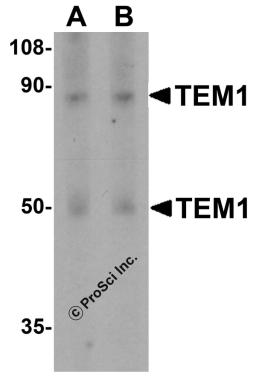 Western blot analysis of TEM1 in human colon tissue lysate with TEM1 antibody at (A) 0.5 and (B) 1 &#956;g/mL.