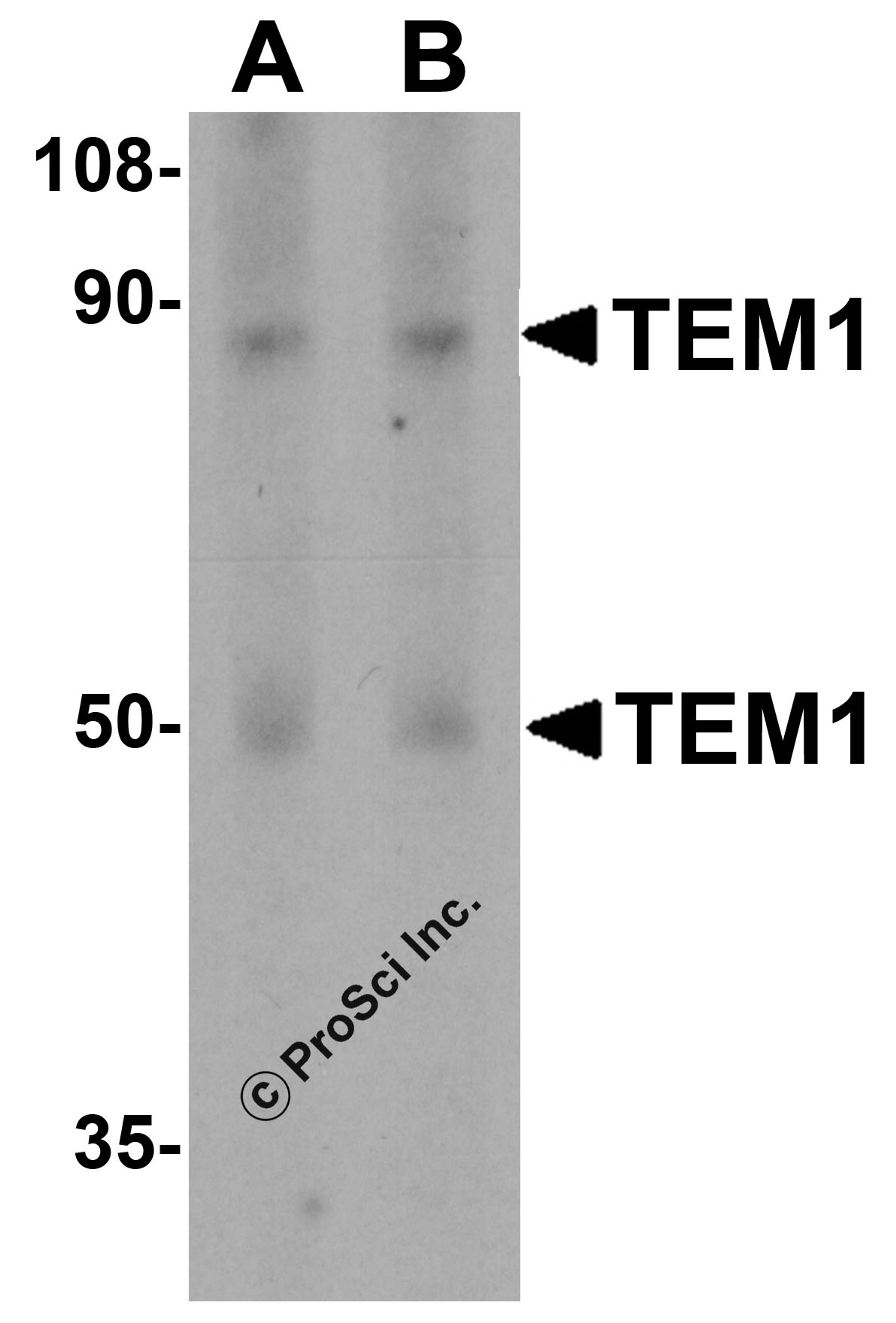 Western blot analysis of TEM1 in human colon tissue lysate with TEM1 antibody at (A) 0.5 and (B) 1 &#956;g/mL.