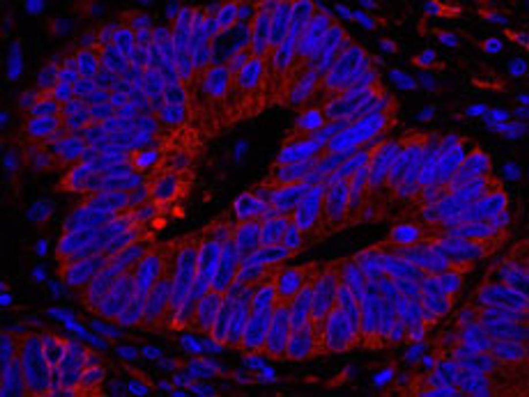 Detection of human Reticulocalbin by immunohistochemistry.