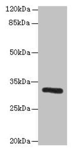 Western blot. All lanes: PPP1R3B antibody at 6µg/ml + Mouse liver tissue. Secondary. Goat polyclonal to rabbit IgG at 1/10000 dilution. Predicted band size: 33 kDa. Observed band size: 33 kDa