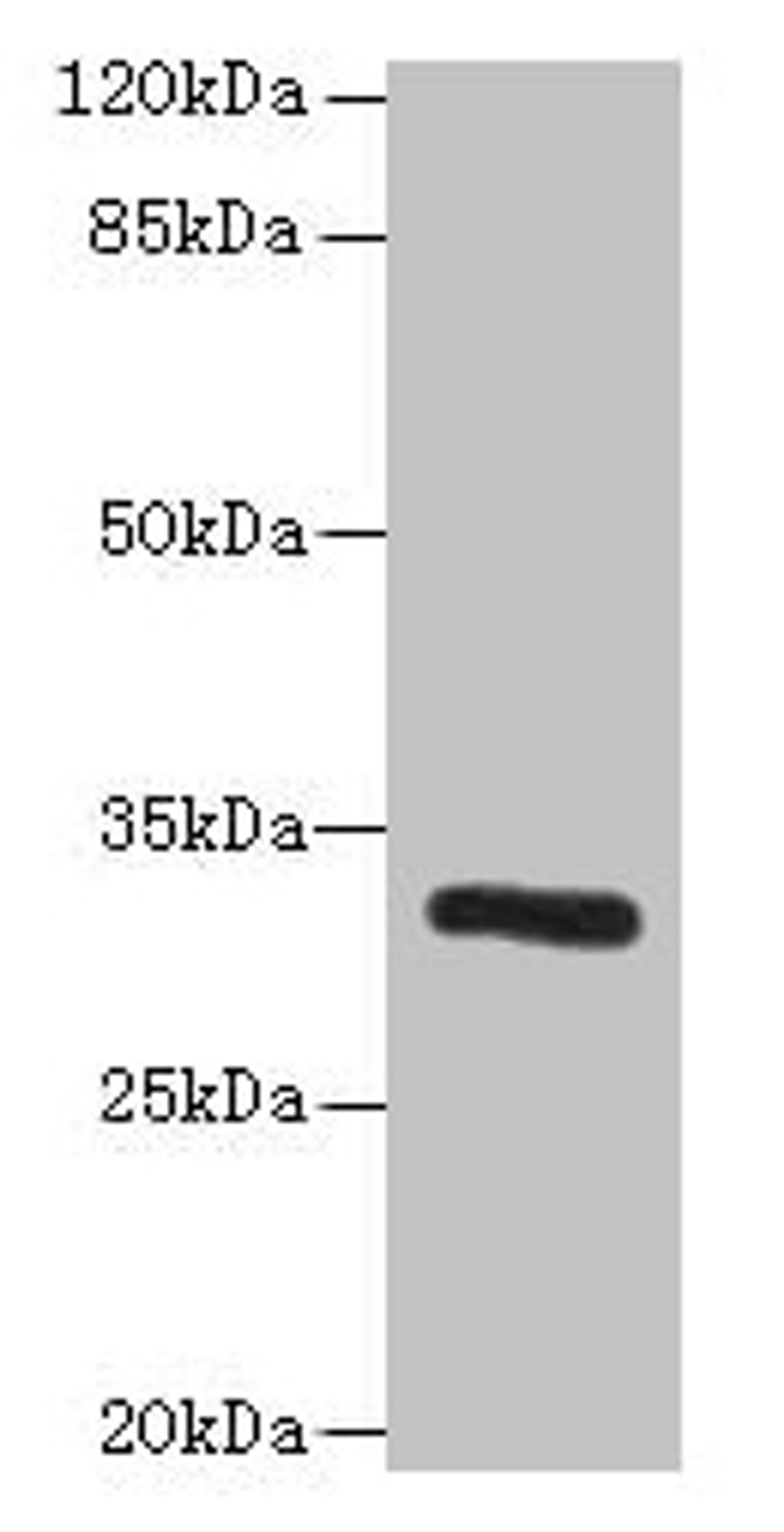 Western blot. All lanes: PPP1R3B antibody at 6µg/ml + Mouse liver tissue. Secondary. Goat polyclonal to rabbit IgG at 1/10000 dilution. Predicted band size: 33 kDa. Observed band size: 33 kDa