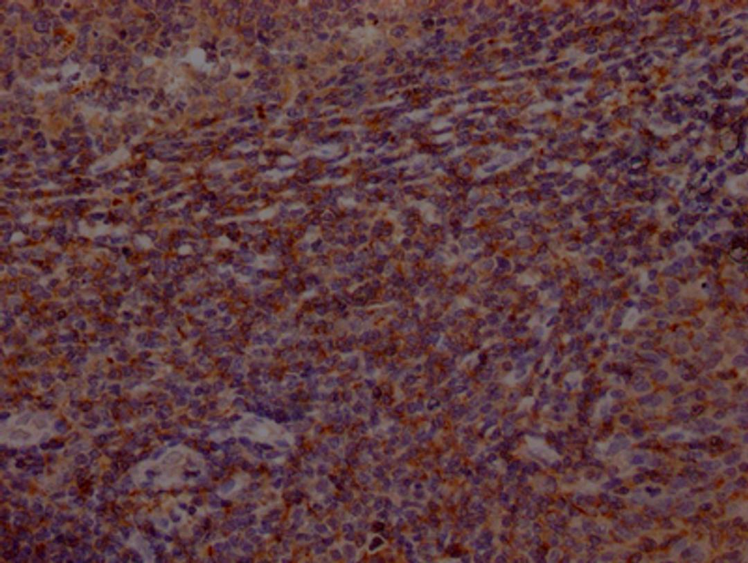 IHC image of CSB-RA553167A0HU diluted at 1:100 and staining in paraffin-embedded human tonsil tissue performed on a Leica BondTM system. After dewaxing and hydration, antigen retrieval was mediated by high pressure in a citrate buffer (pH 6.0). Section was blocked with 10% normal goat serum 30min at RT. Then primary antibody (1% BSA) was incubated at 4℃ overnight. The primary is detected by a Goat anti-rabbit IgG polymer labeled by HRP and visualized using 0.05% DAB.