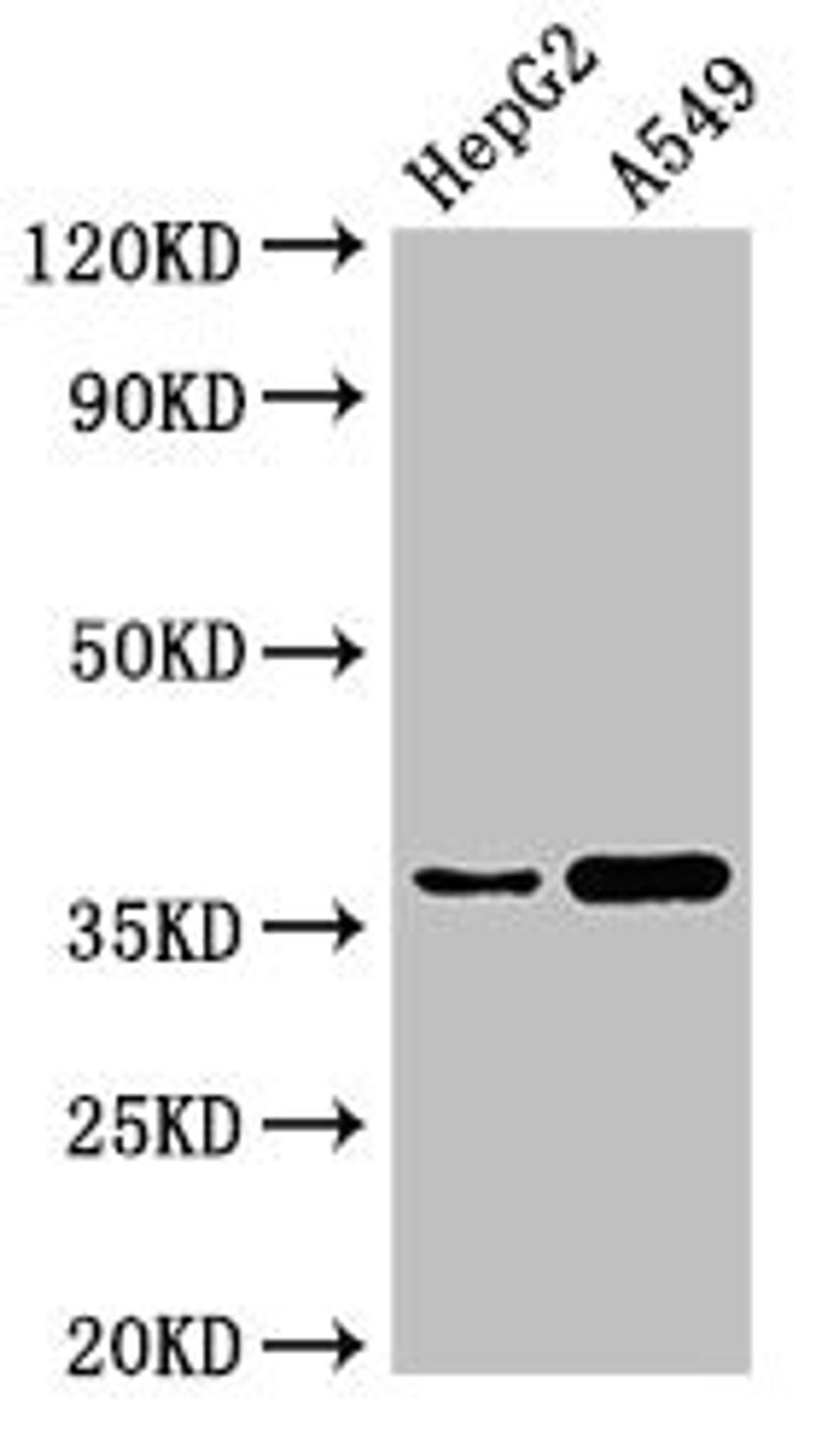 Western Blot. Positive WB detected in: HepG2 whole cell lysate, A549 whole cell lysate. All lanes: GGH antibody at 3µg/ml. Secondary. Goat polyclonal to rabbit IgG at 1/50000 dilution. Predicted band size: 36 kDa. Observed band size: 36 kDa