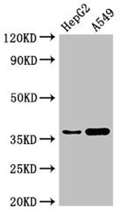 Western Blot. Positive WB detected in: HepG2 whole cell lysate, A549 whole cell lysate. All lanes: GGH antibody at 3µg/ml. Secondary. Goat polyclonal to rabbit IgG at 1/50000 dilution. Predicted band size: 36 kDa. Observed band size: 36 kDa