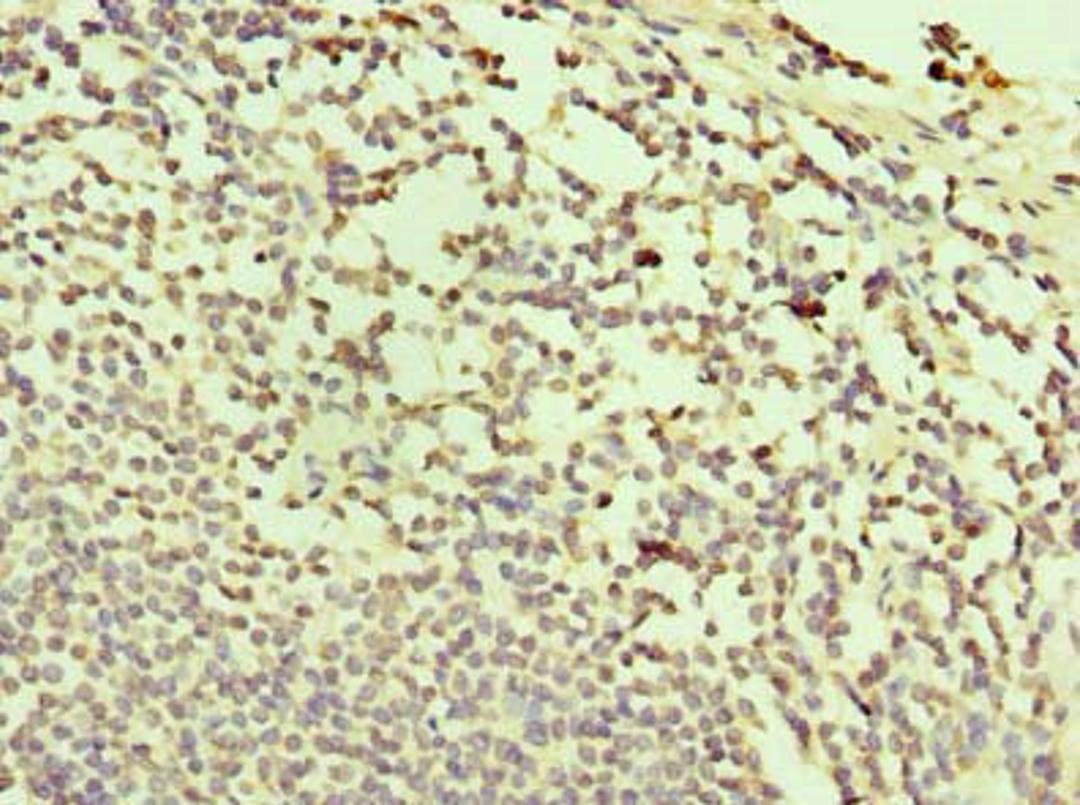 Immunohistochemistry of paraffin-embedded human small intestine tissue using CSB-PA761361LA01HU at dilution of 1:100