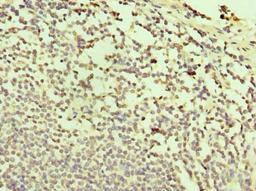 Immunohistochemistry of paraffin-embedded human small intestine tissue using CSB-PA761361LA01HU at dilution of 1:100