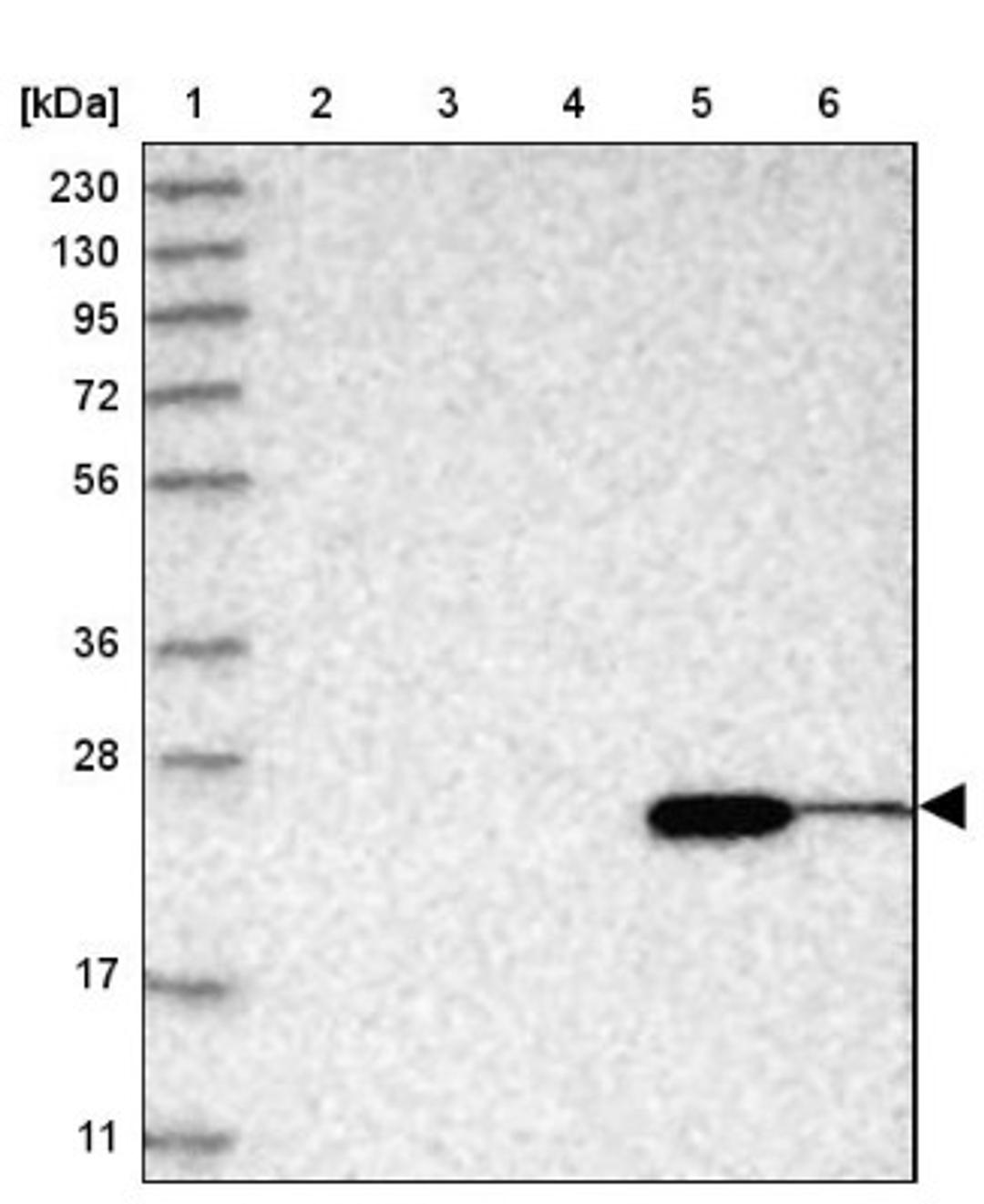 Western Blot: ABHD14B Antibody [NBP1-84472] - Lane 1: Marker [kDa] 230, 130, 95, 72, 56, 36, 28, 17, 11<br/>Lane 2: Human cell line RT-4<br/>Lane 3: Human cell line U-251MG sp<br/>Lane 4: Human plasma (IgG/HSA depleted)<br/>Lane 5: Human liver tissue<br/>Lane 6: Human tonsil tissue