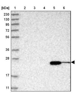 Western Blot: ABHD14B Antibody [NBP1-84472] - Lane 1: Marker [kDa] 230, 130, 95, 72, 56, 36, 28, 17, 11<br/>Lane 2: Human cell line RT-4<br/>Lane 3: Human cell line U-251MG sp<br/>Lane 4: Human plasma (IgG/HSA depleted)<br/>Lane 5: Human liver tissue<br/>Lane 6: Human tonsil tissue