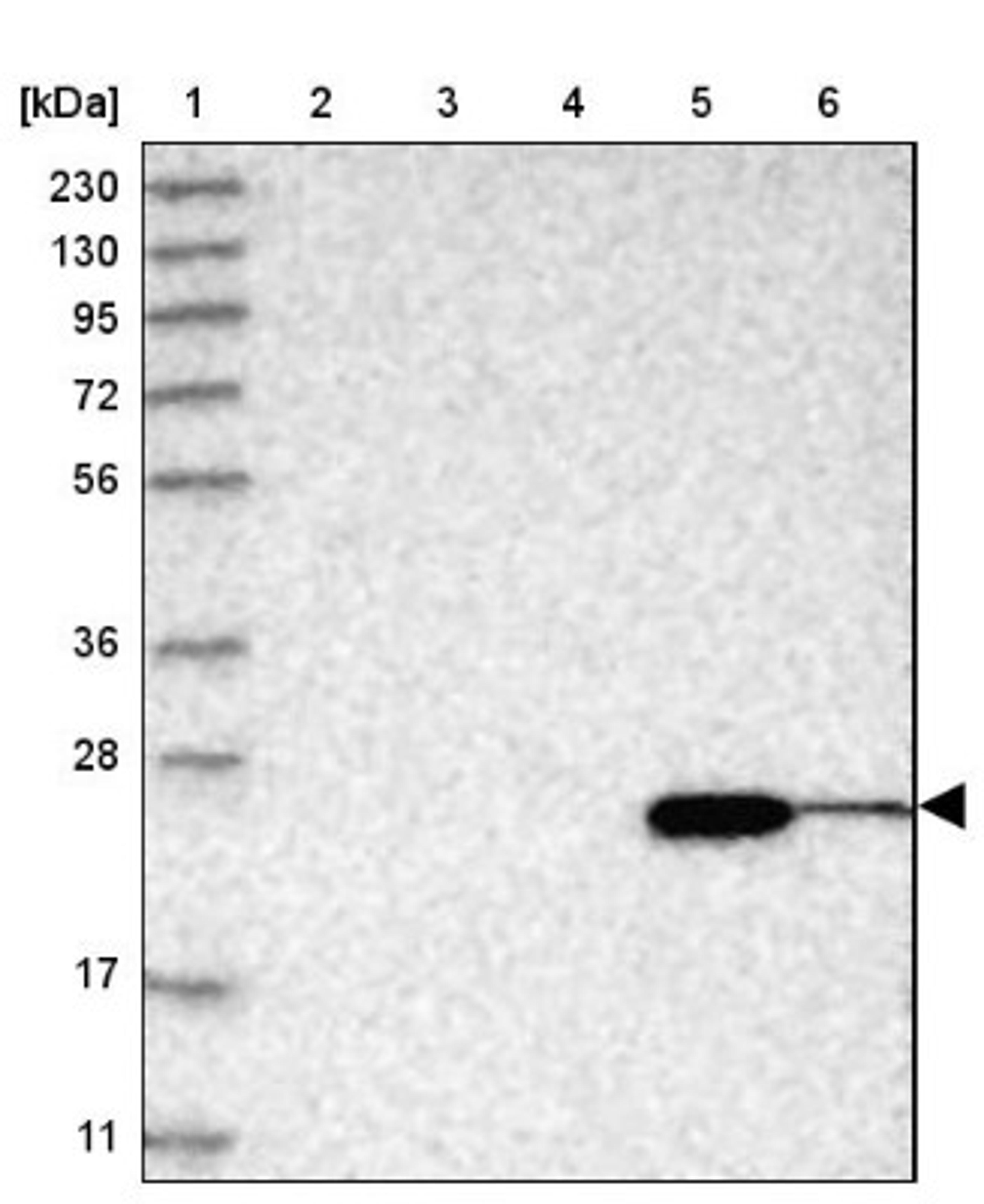 Western Blot: ABHD14B Antibody [NBP1-84472] - Lane 1: Marker [kDa] 230, 130, 95, 72, 56, 36, 28, 17, 11<br/>Lane 2: Human cell line RT-4<br/>Lane 3: Human cell line U-251MG sp<br/>Lane 4: Human plasma (IgG/HSA depleted)<br/>Lane 5: Human liver tissue<br/>Lane 6: Human tonsil tissue