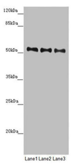 Western blot. All lanes: PMPCB antibody at 0.69 ug/ml. Lane 1: Mouse heart tissue. Lane 2: Mouse kidney tissue. Lane 3: Mouse liver tissue. Secondary. Goat polyclonal to rabbit IgG at 1/10000 dilution. Predicted band size: 54 kDa. Observed band size: 54 kDa.