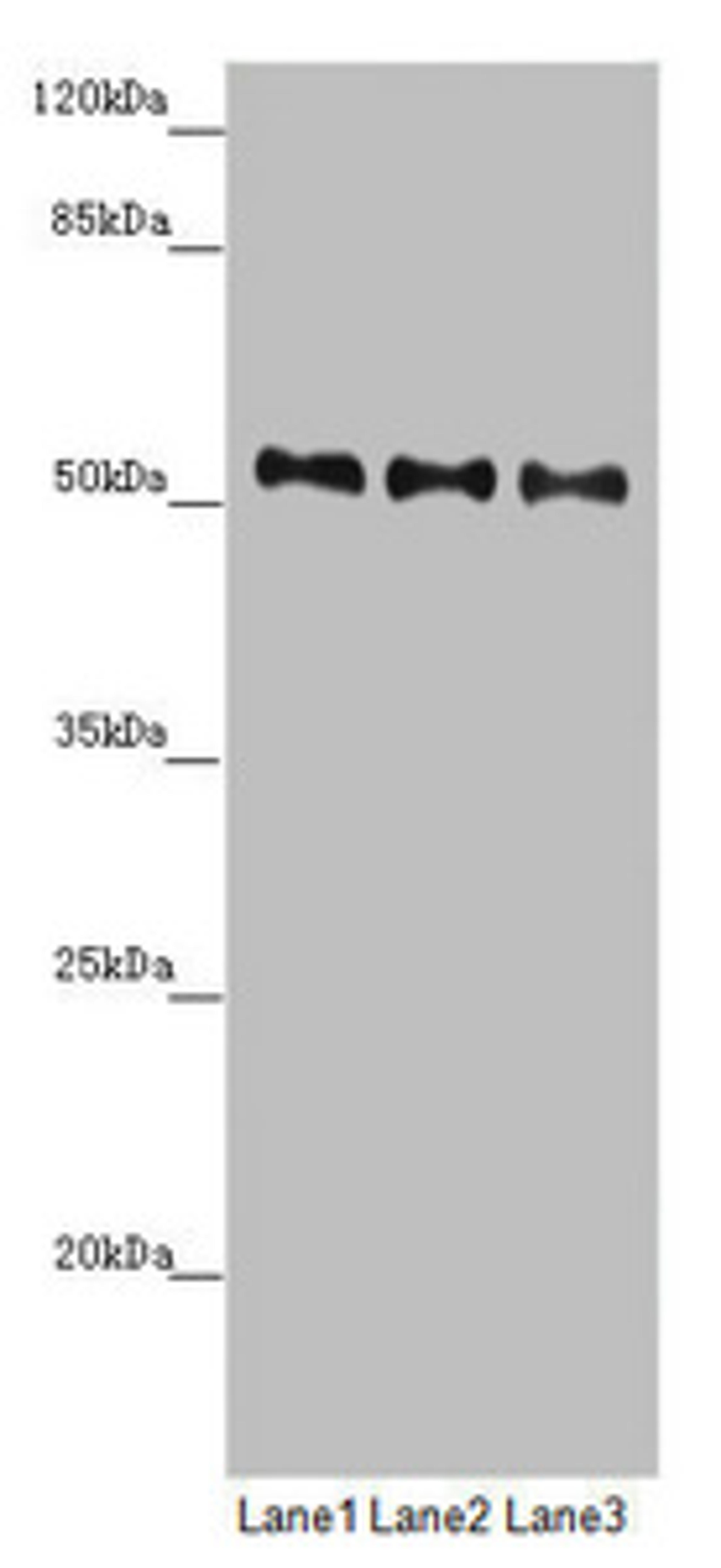 Western blot. All lanes: PMPCB antibody at 0.69 ug/ml. Lane 1: Mouse heart tissue. Lane 2: Mouse kidney tissue. Lane 3: Mouse liver tissue. Secondary. Goat polyclonal to rabbit IgG at 1/10000 dilution. Predicted band size: 54 kDa. Observed band size: 54 kDa.