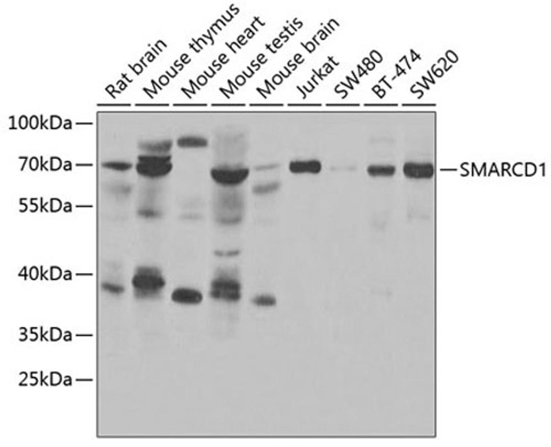 Western blot - SMARCD1 antibody (A6310)