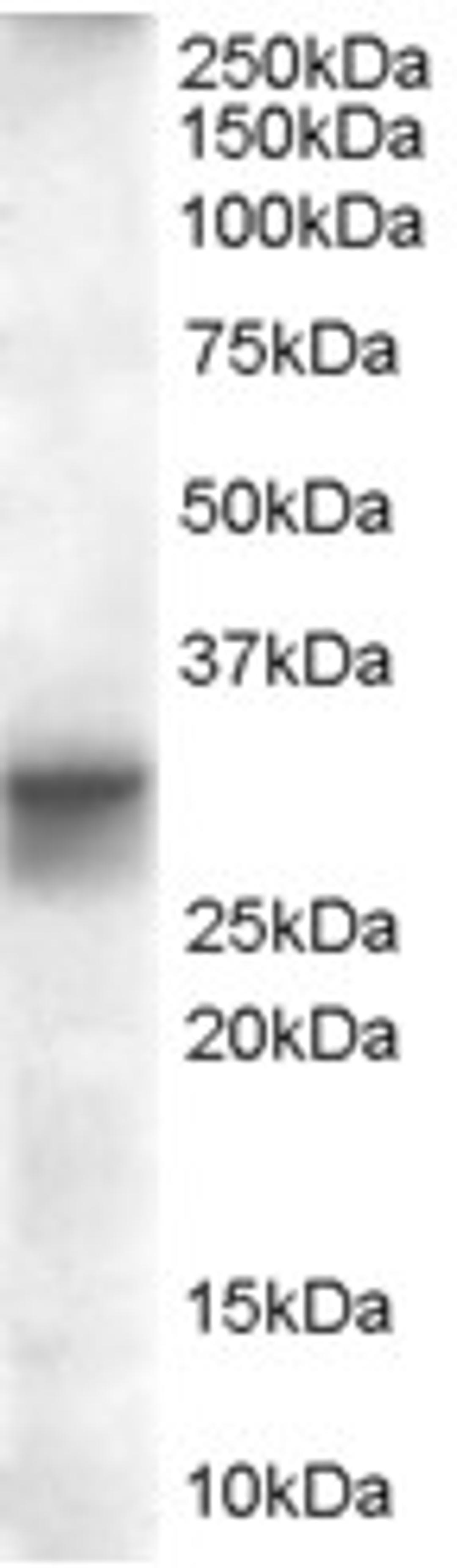 46-380 (0.01ug/ml) staining of Human Heart lysate (35ug protein in RIPA buffer). Primary incubation was 1 hour. Detected by chemiluminescence.