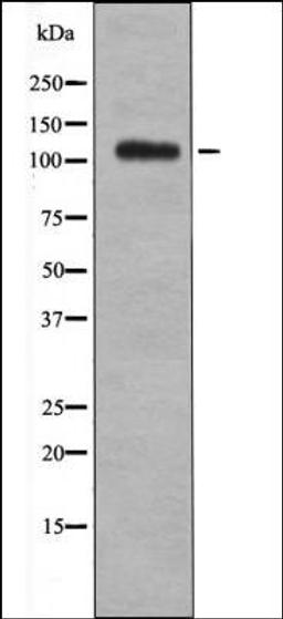 Western blot analysis of UV treated 293 whole cell lysates using EPHB1/2/3/4 -Phospho-Tyr600/602/614/596- antibody