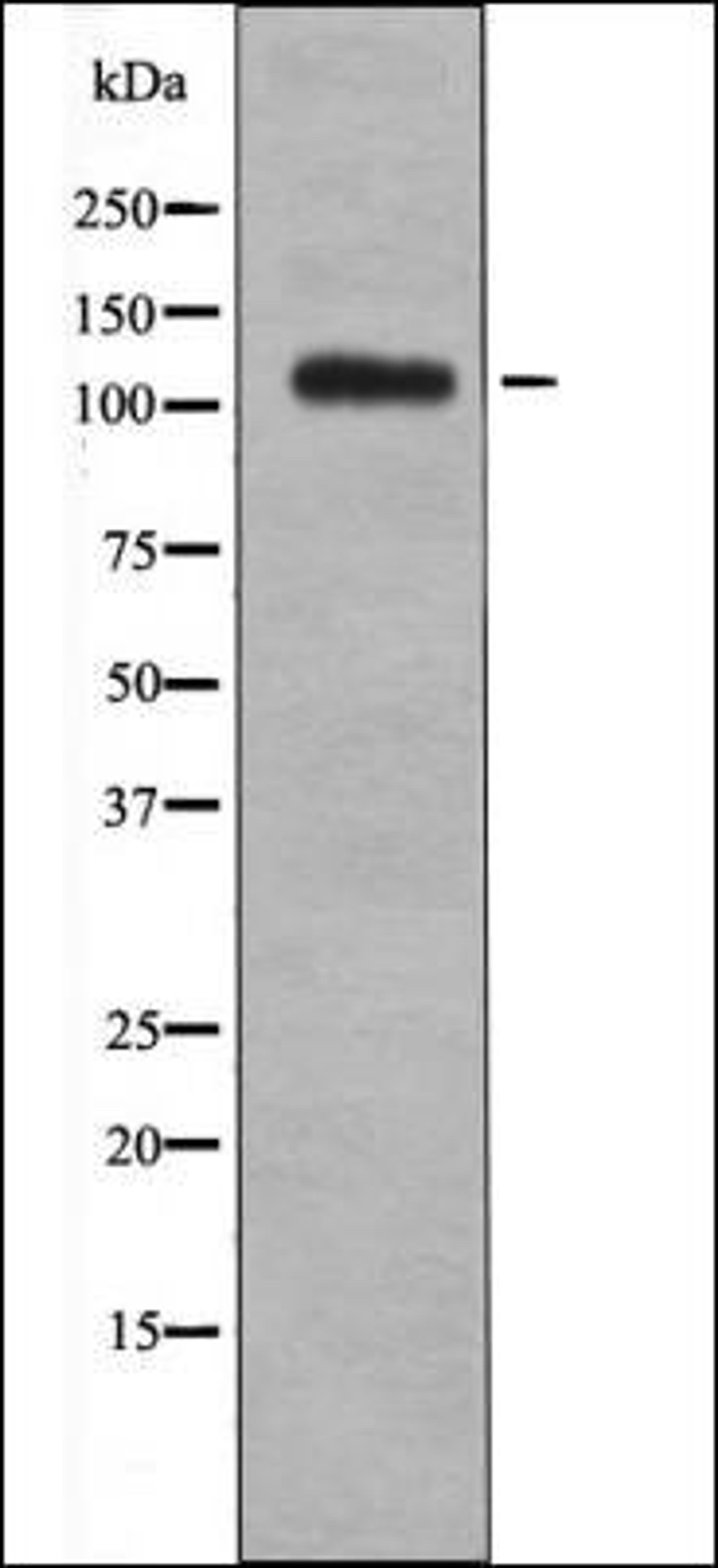 Western blot analysis of UV treated 293 whole cell lysates using EPHB1/2/3/4 -Phospho-Tyr600/602/614/596- antibody