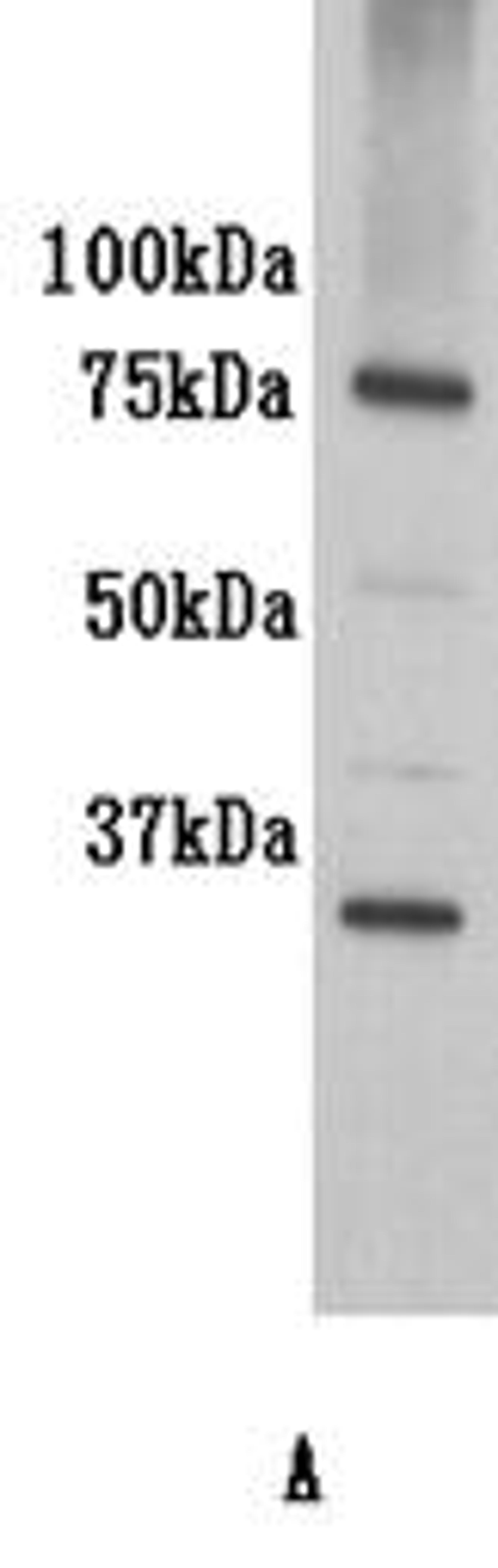 Western Blot analysis of K562 using IL7 Receptor alpha antibody