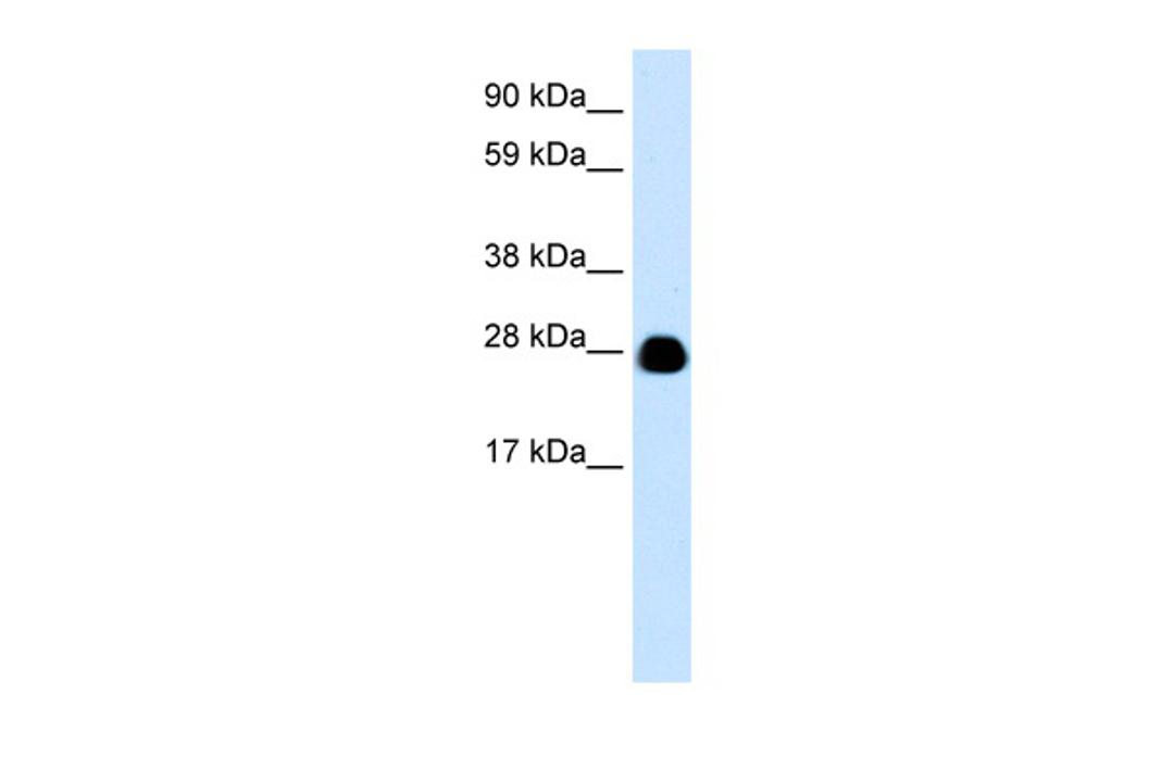 Antibody used in WB on Human brain at 0.2-1 ug/ml.