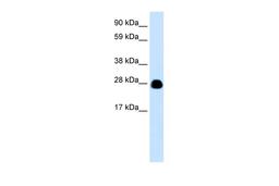 Antibody used in WB on Human brain at 0.2-1 ug/ml.