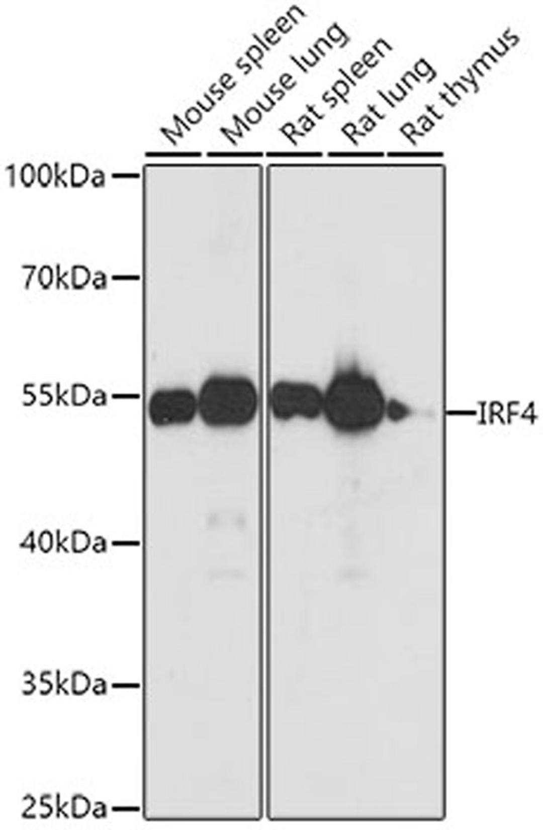 Western blot - IRF4 antibody (A0524)