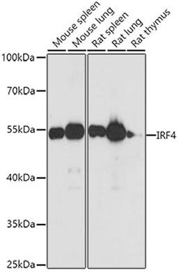 Western blot - IRF4 antibody (A0524)