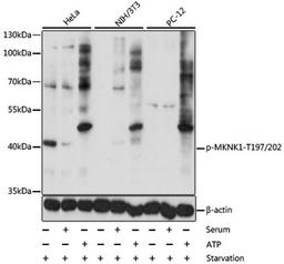 Western blot - Phospho-MKNK1-T197/202 antibody (AP0544)