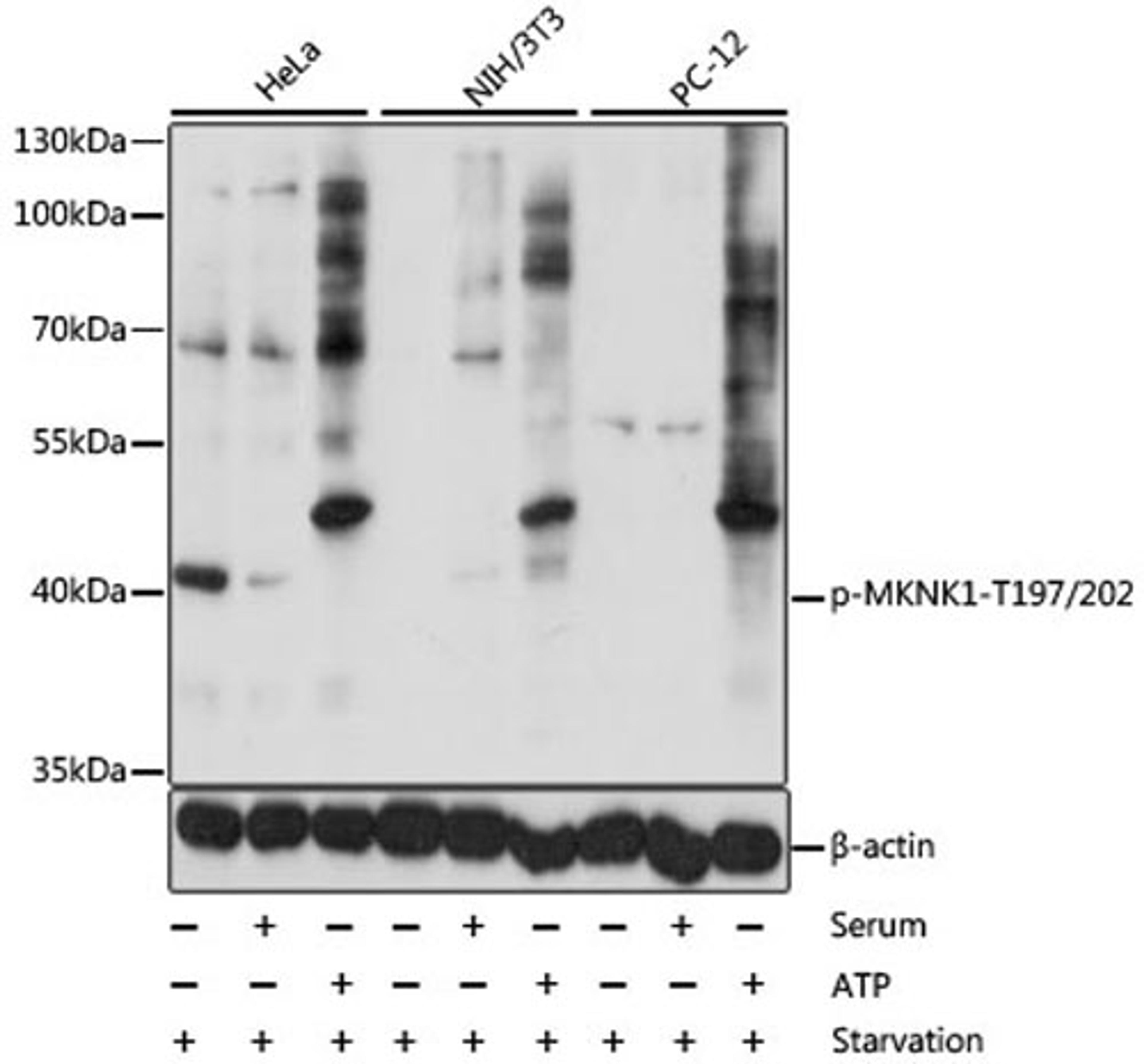 Western blot - Phospho-MKNK1-T197/202 antibody (AP0544)