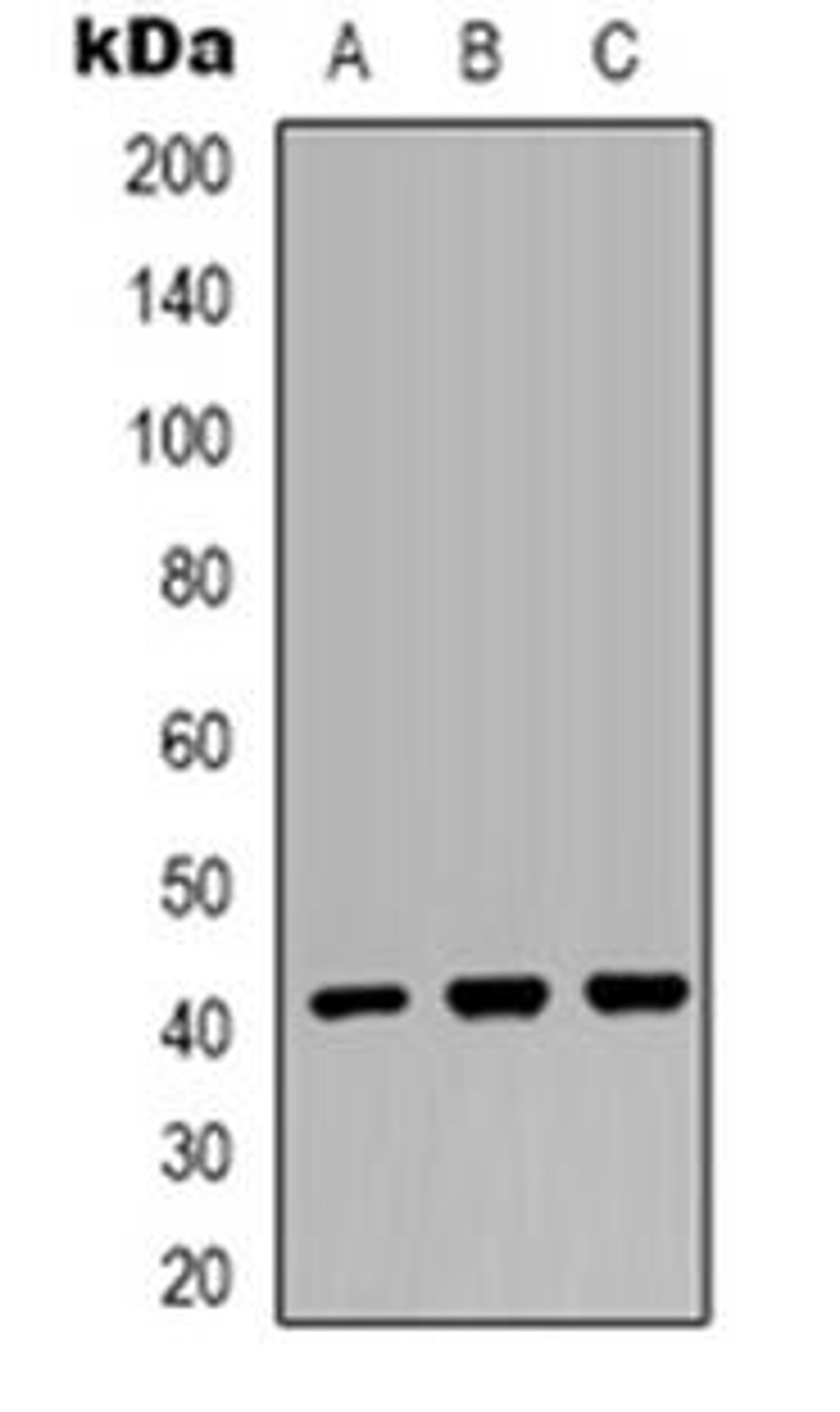 Western blot analysis of MRPS22 expression in HEK293T (Lane 1), mouse brain (Lane 2), COS7 (Lane 3) whole cell lysates using MRPS22 antibody