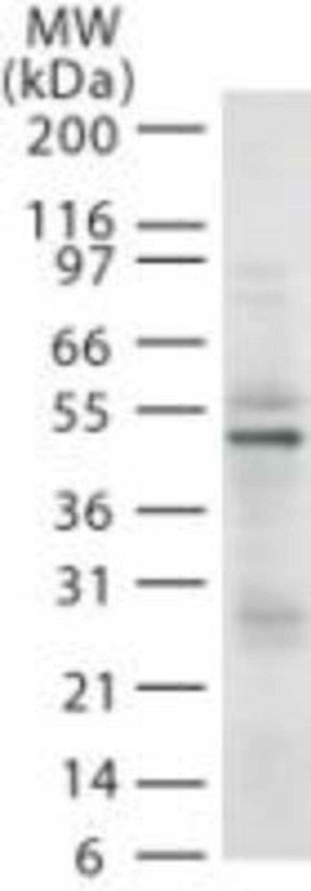 Western Blot: RAD18 Antibody (79B1048.1) [NB100-56523] - The anti-Rad18 mAb was diluted at 2 ug/ml and tested against 20 ug of HL-60 cell lysate.