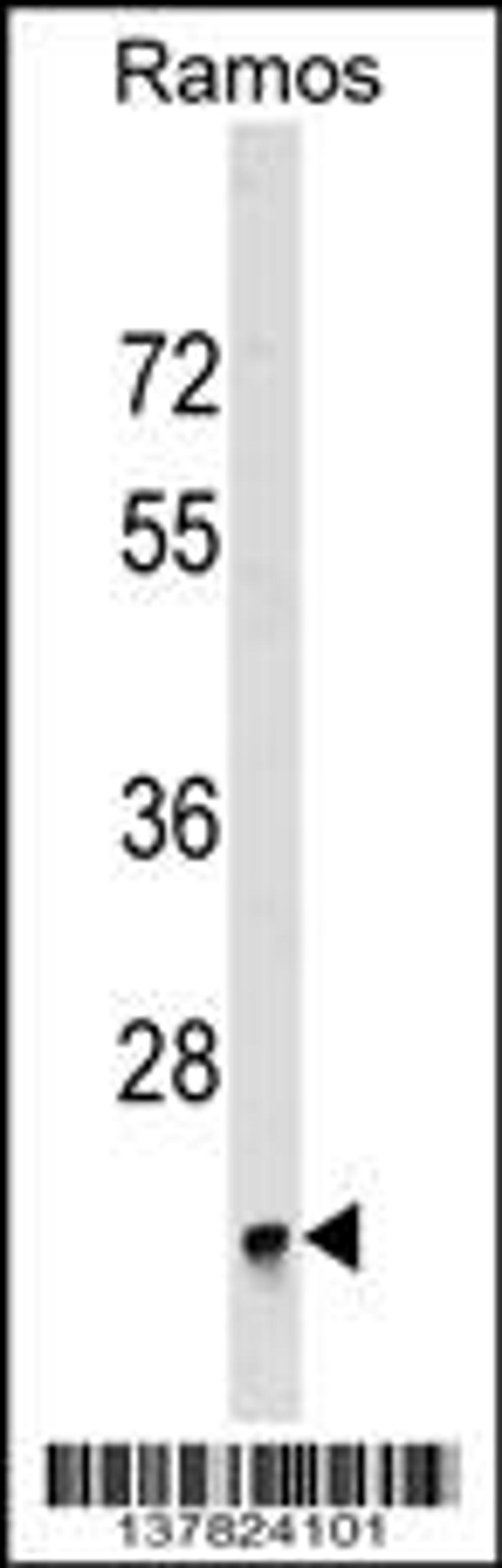 Western blot analysis in Ramos cell line lysates (35ug/lane).