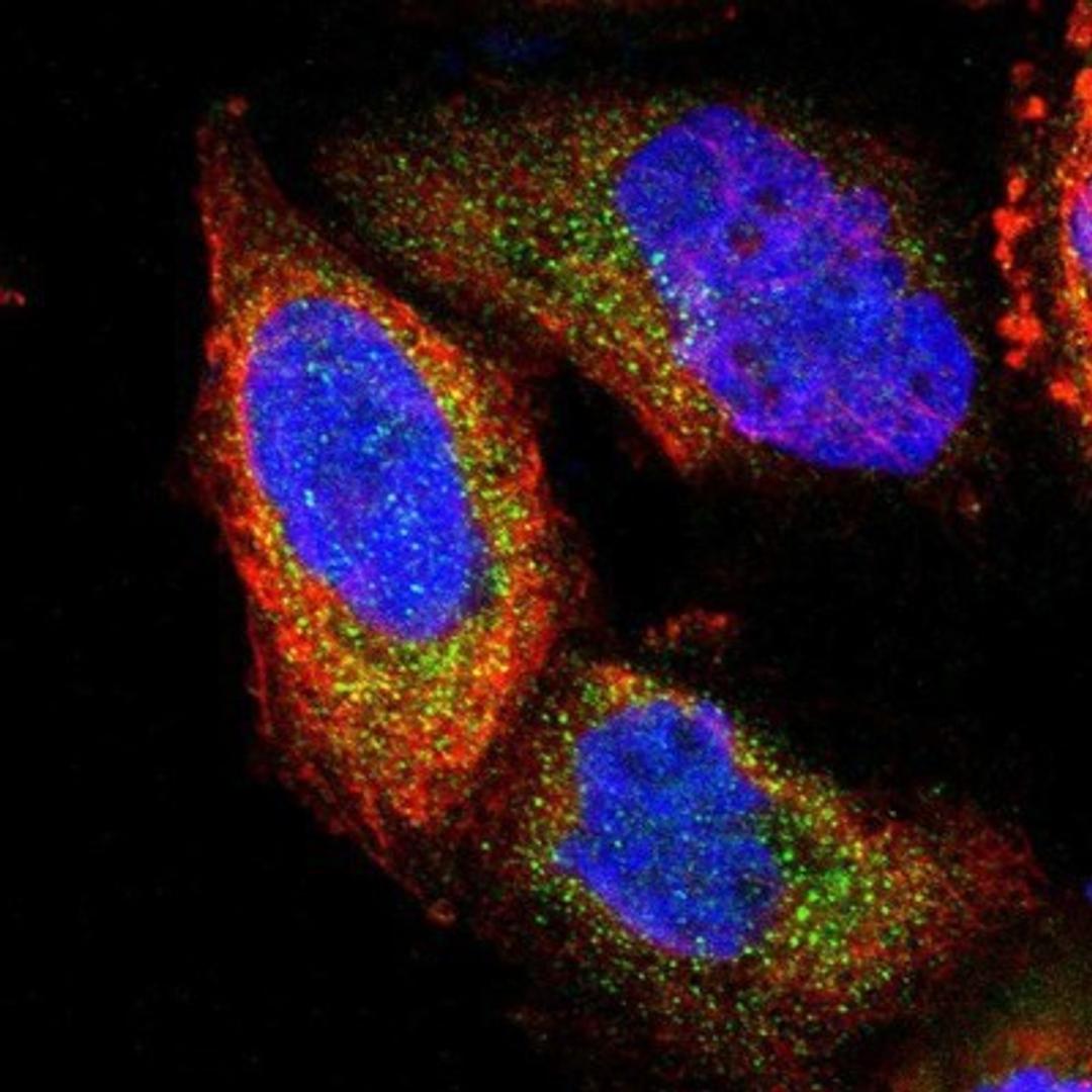 Immunocytochemistry/Immunofluorescence: PNMA1 Antibody [NBP1-82807] - Staining of human cell line A-431 shows positivity in cytoplasm.