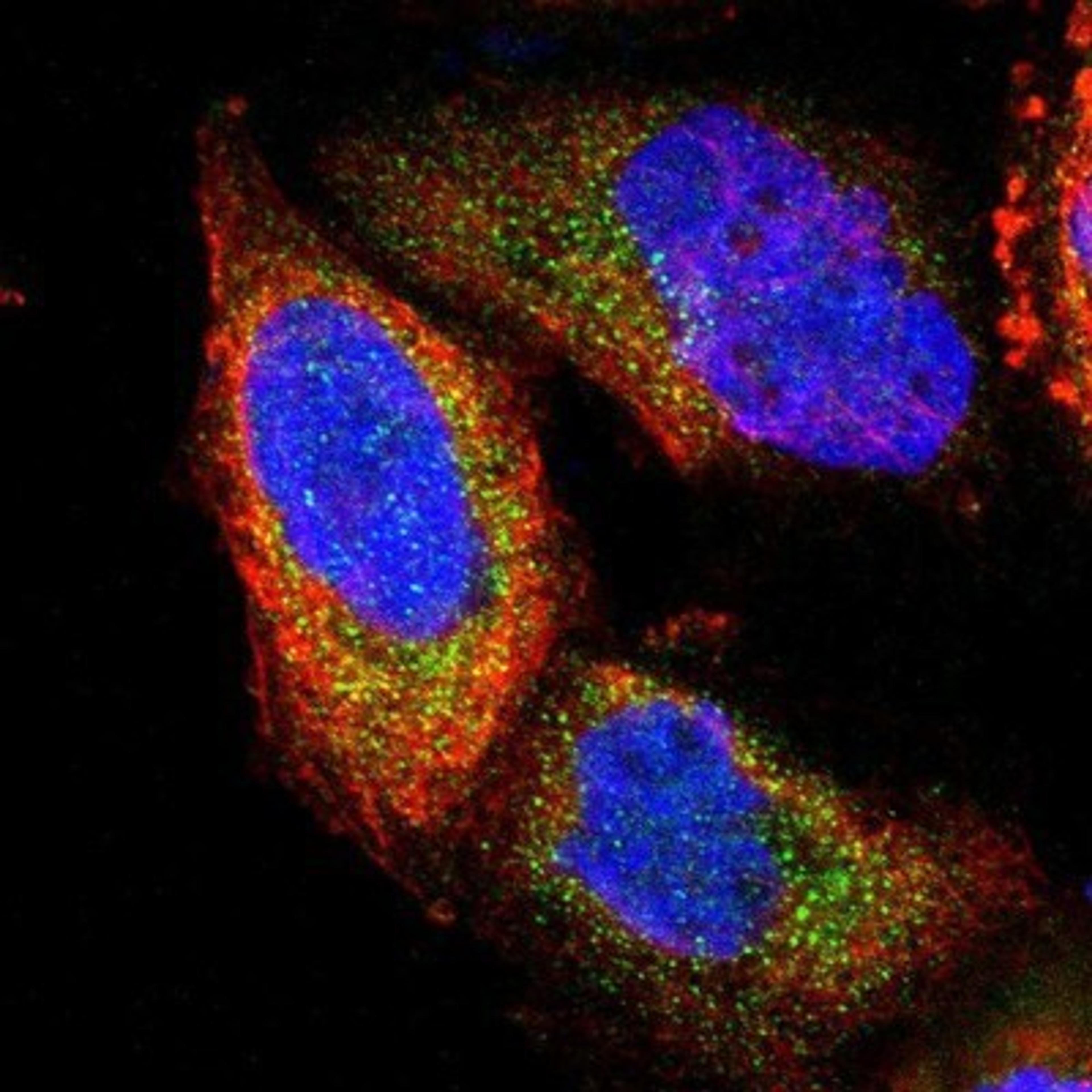 Immunocytochemistry/Immunofluorescence: PNMA1 Antibody [NBP1-82807] - Staining of human cell line A-431 shows positivity in cytoplasm.