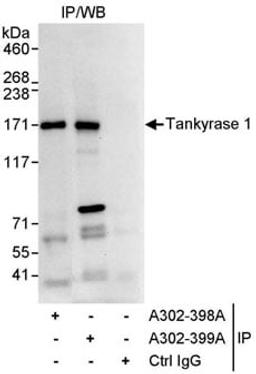 Detection of human Tankyrase 1 by western blot of immunoprecipitates.