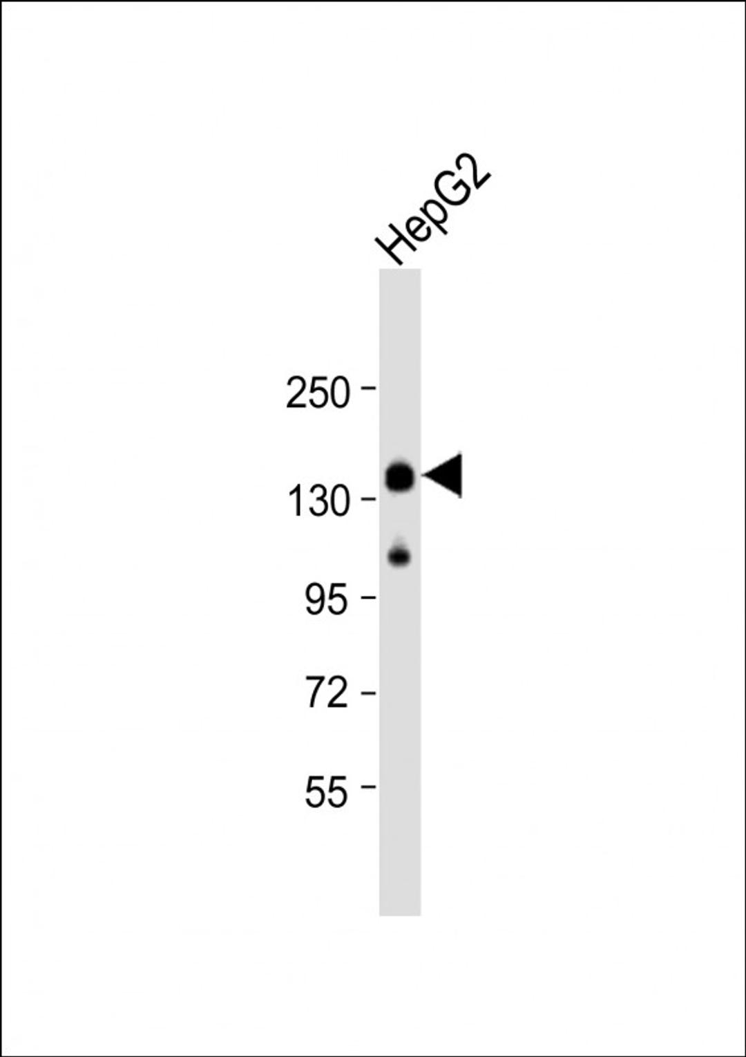 Western Blot at 1:2000 dilution + HepG2 whole cell lysate Lysates/proteins at 20 ug per lane.