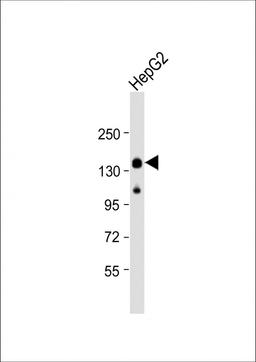 Western Blot at 1:2000 dilution + HepG2 whole cell lysate Lysates/proteins at 20 ug per lane.