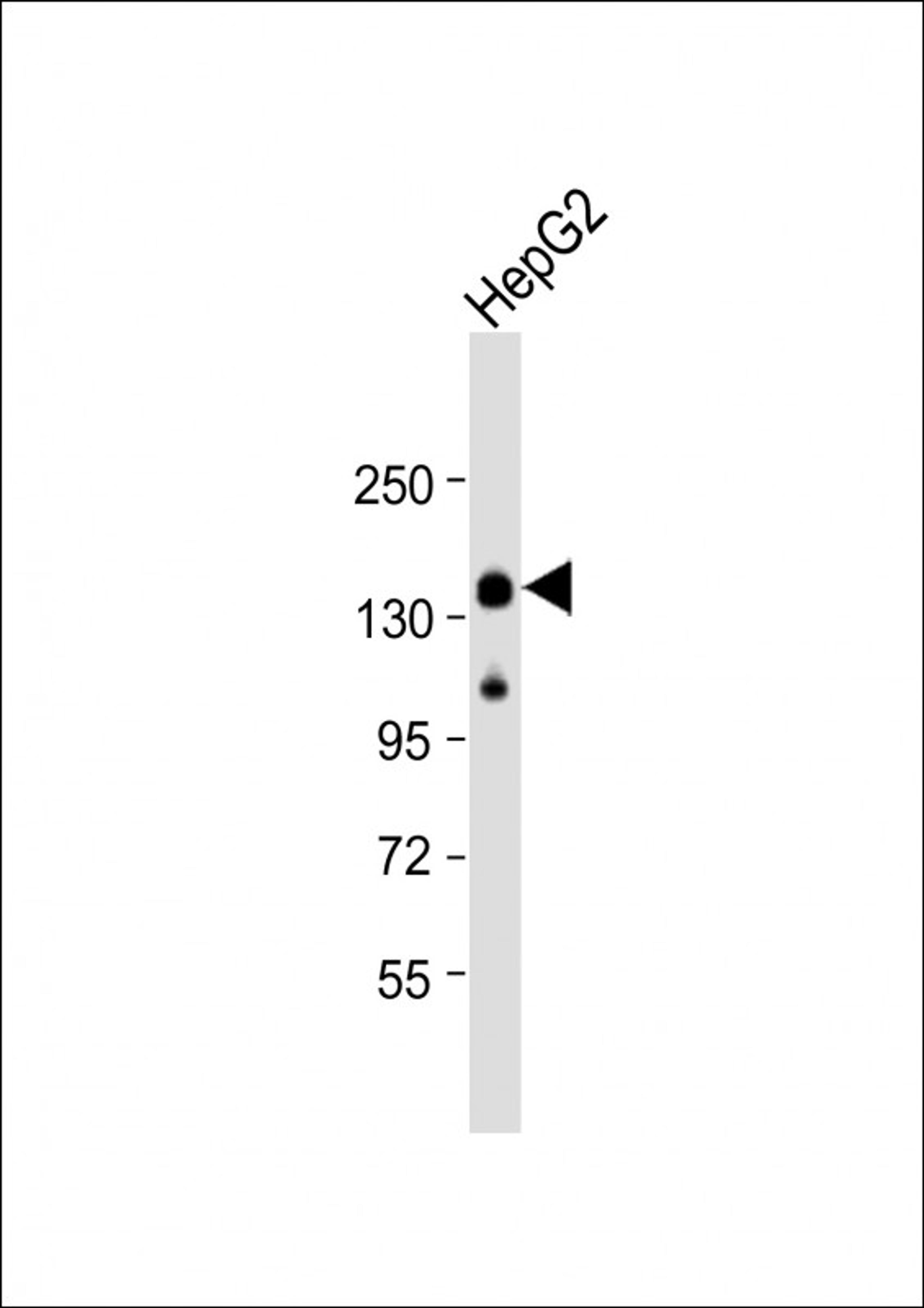 Western Blot at 1:2000 dilution + HepG2 whole cell lysate Lysates/proteins at 20 ug per lane.