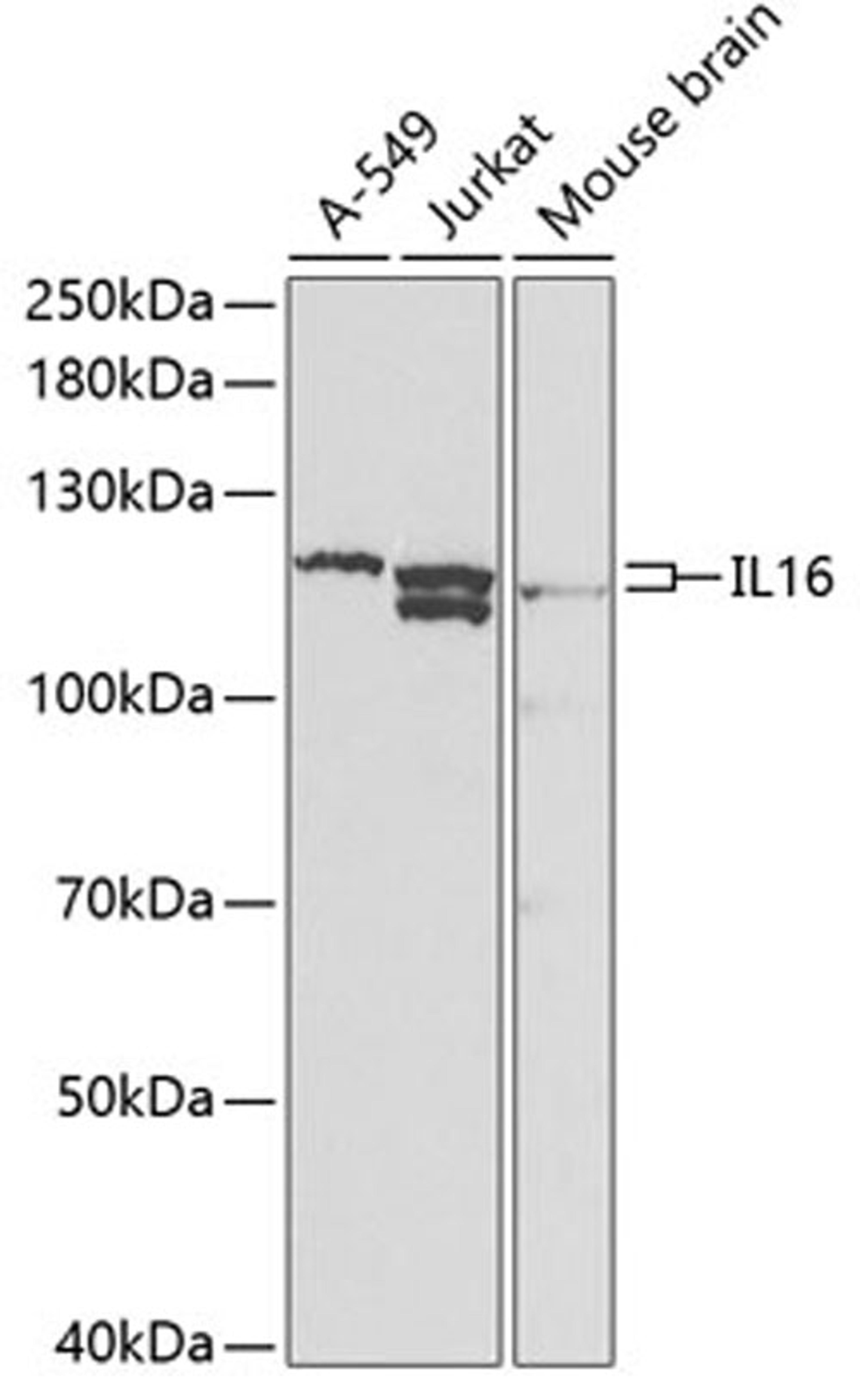 Western blot - IL16 antibody (A1764)