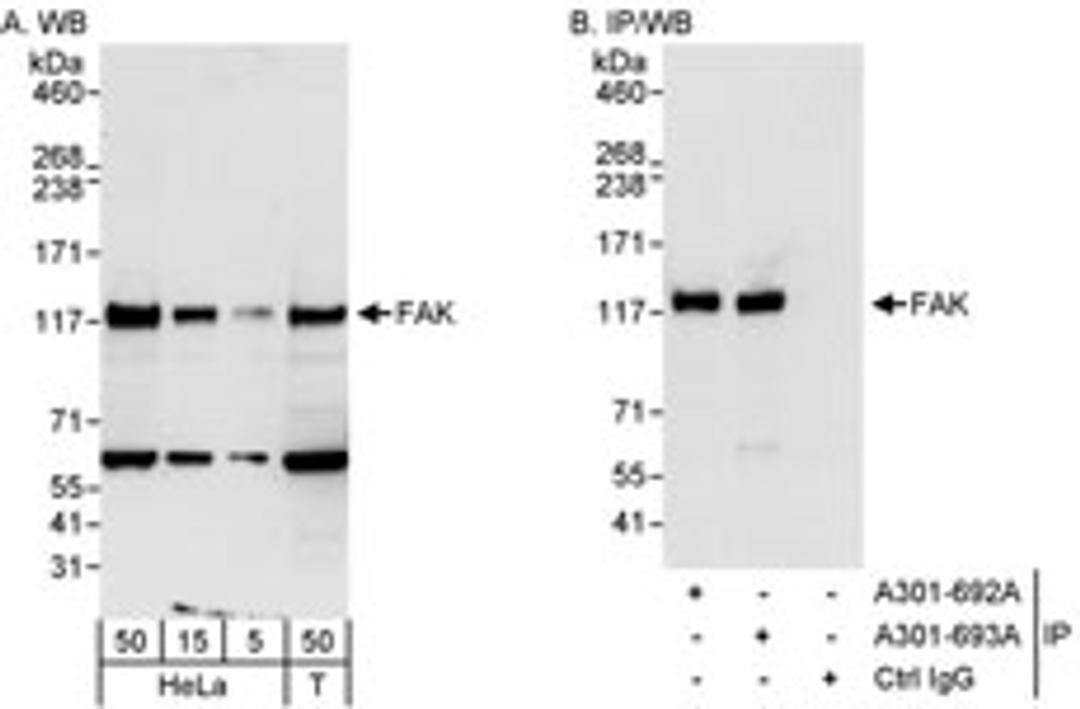 Detection of human FAK by western blot and immunoprecipitation.