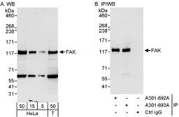 Detection of human FAK by western blot and immunoprecipitation.